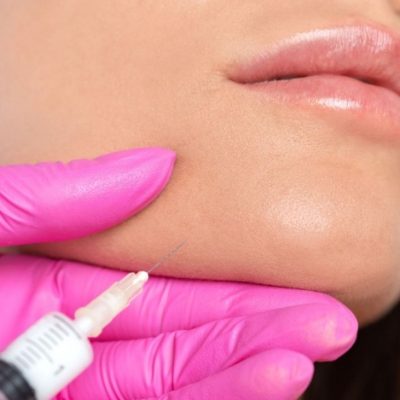 Preenchimento de mandibula