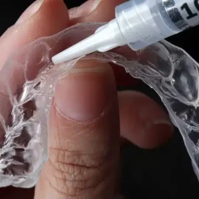 clareamento caseiro na moldeira