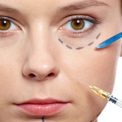 preenchimento de olheira