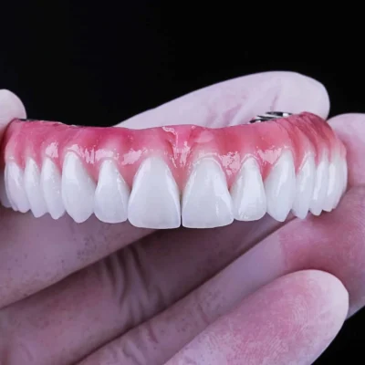 protocolo sobre implante (1)